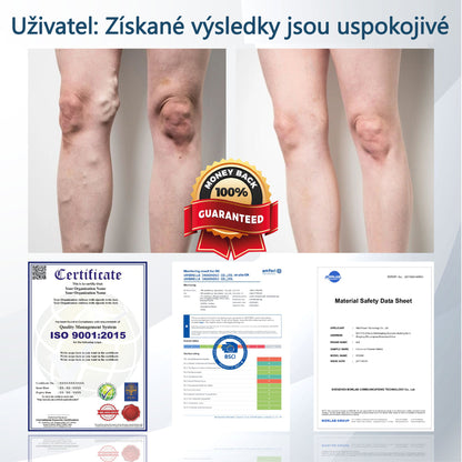 ATTDX® Černý kmín – bylinný krém na zklidnění otoků🌿🦵
