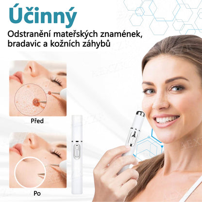 Foulme® PRO Neinvazivní laserové pero na odstraňování bradavic a znamének💎💎