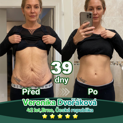 Lékárna Na Poště | 𝐿𝑜𝑡𝑚𝑎𝑦® Kapky s kmenovými buňkami a kolagenovými peptidy pro vnitřní použití  💧 (Zpevnění a lifting povolené pokožky & redukce tvorby vrásek) ❤️‍🔥（副本）