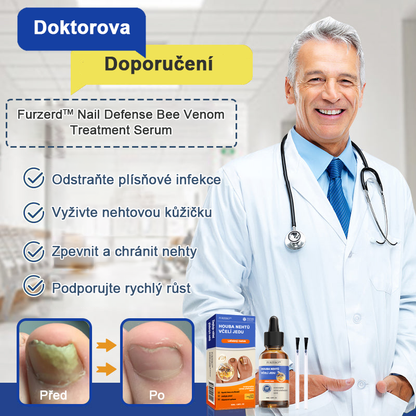 🐝Furzero™ Včelí jed na plíseň nehtů: kompletní řešení plísně nehtů 👣