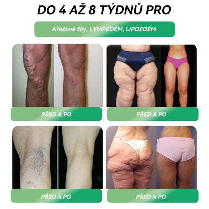 🌿 Oficiální obchod ČR | STDEI® GLP-1 8-v-1 Fit & Vital Řešení (Jednou denně, viditelné změny za 7 dní) 💎 Obezita, kardiovaskulární zdraví, cukrovka, spánková apnoe, zdraví střev, problémy se klouby a další