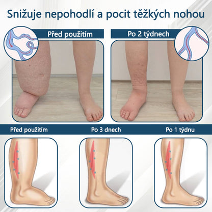 ATTDX® Černý kmín – bylinný krém na zklidnění otoků🌿🦵