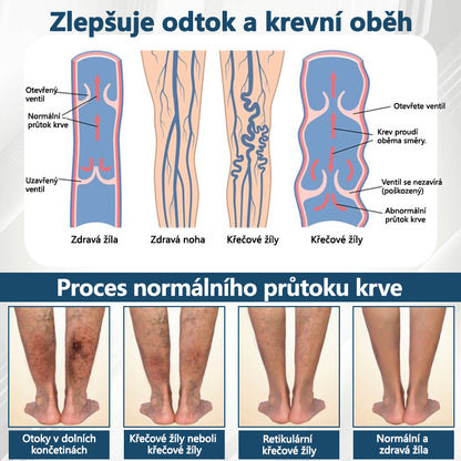 ATTDX® Černý kmín – bylinný krém na zklidnění otoků🌿🦵