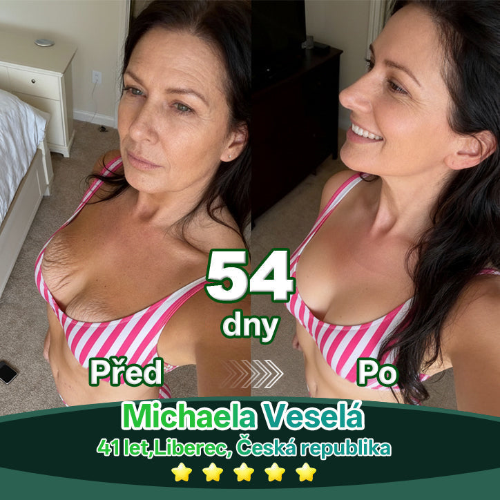 Lékárna Na Poště | 𝐿𝑜𝑡𝑚𝑎𝑦® Kapky s kmenovými buňkami a kolagenovými peptidy pro vnitřní použití  💧 (Zpevnění a lifting povolené pokožky & redukce tvorby vrásek) ❤️‍🔥（副本）