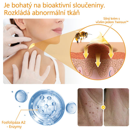 Twinsun™ Extra Silný Krém s včelím jedem, certifikovaný EMA💖 Na ošetření bradavic, kožních výrůstků, infekcí a keratózy, vyhlazuje nerovnoměrný povrch pokožky🐝