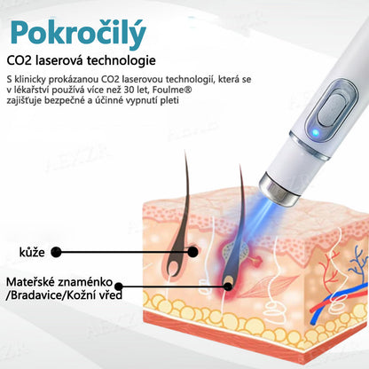 Foulme® PRO Neinvazivní laserové pero na odstraňování bradavic a znamének💎💎