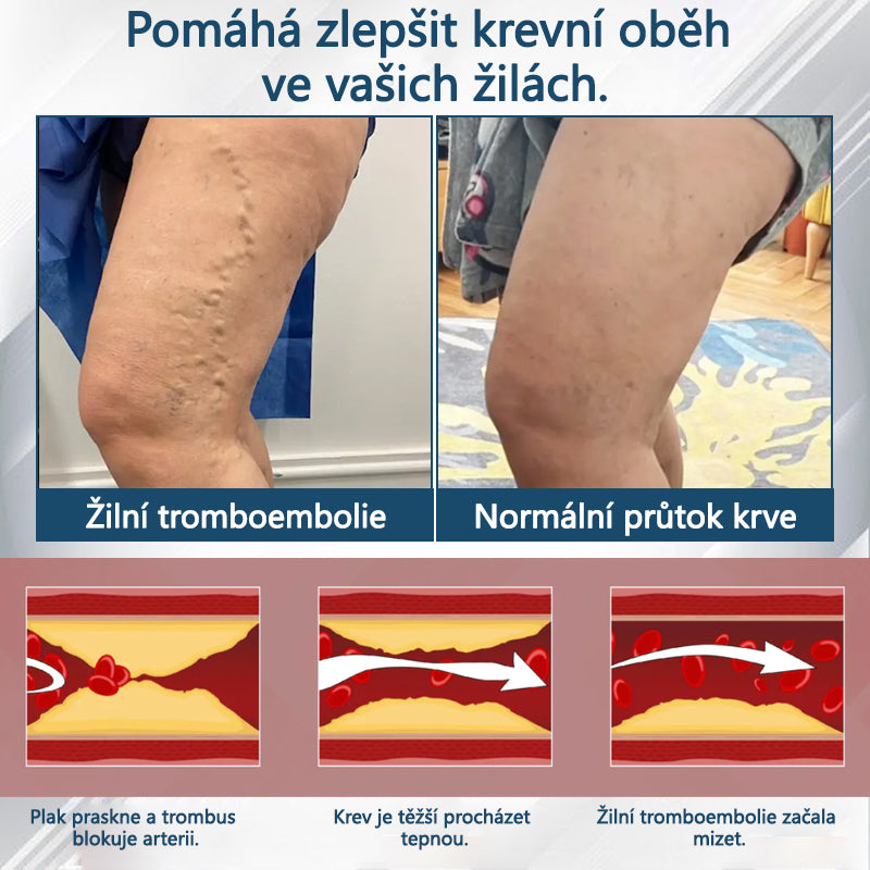 ATTDX® Černý kmín – bylinný krém na zklidnění otoků🌿🦵