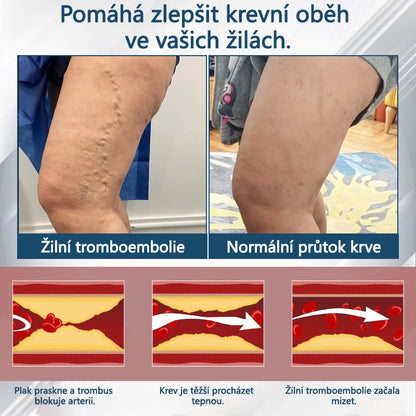 ATTDX® Černý kmín – bylinný krém na zklidnění otoků🌿🦵