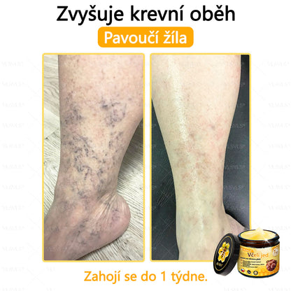 🐝VLSVLS™ Krém s včelím jedem – doporučeno kožními lékaři 🧑‍⚕️ Na různé kožní problémy – fakt účinný a šetrný pomocník