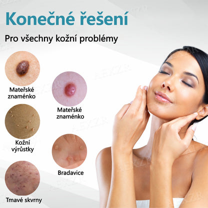 Foulme® PRO Neinvazivní laserové pero na odstraňování bradavic a znamének💎💎