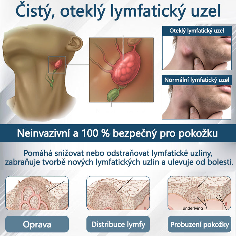 ATTDX® Černý kmín – bylinný krém na zklidnění otoků🌿🦵